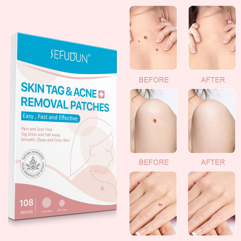 Invisible Patch - Acne Removal