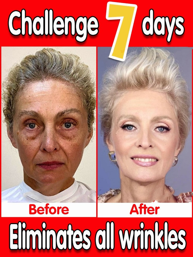 Instant Wrinkle Removal - Face Serum