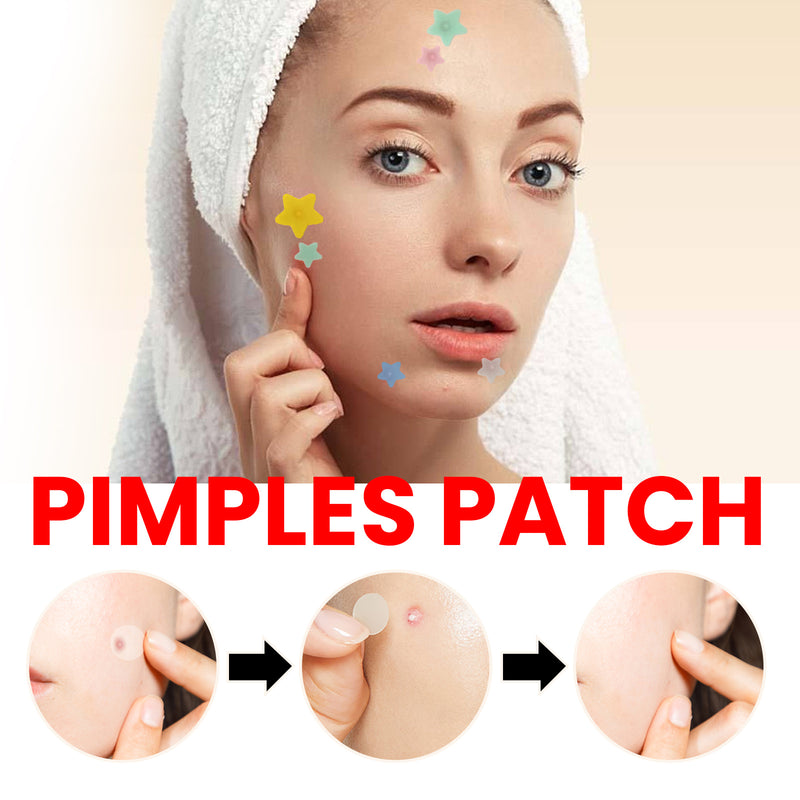 Hydrocolloid Acne Patches - Pimple Removal