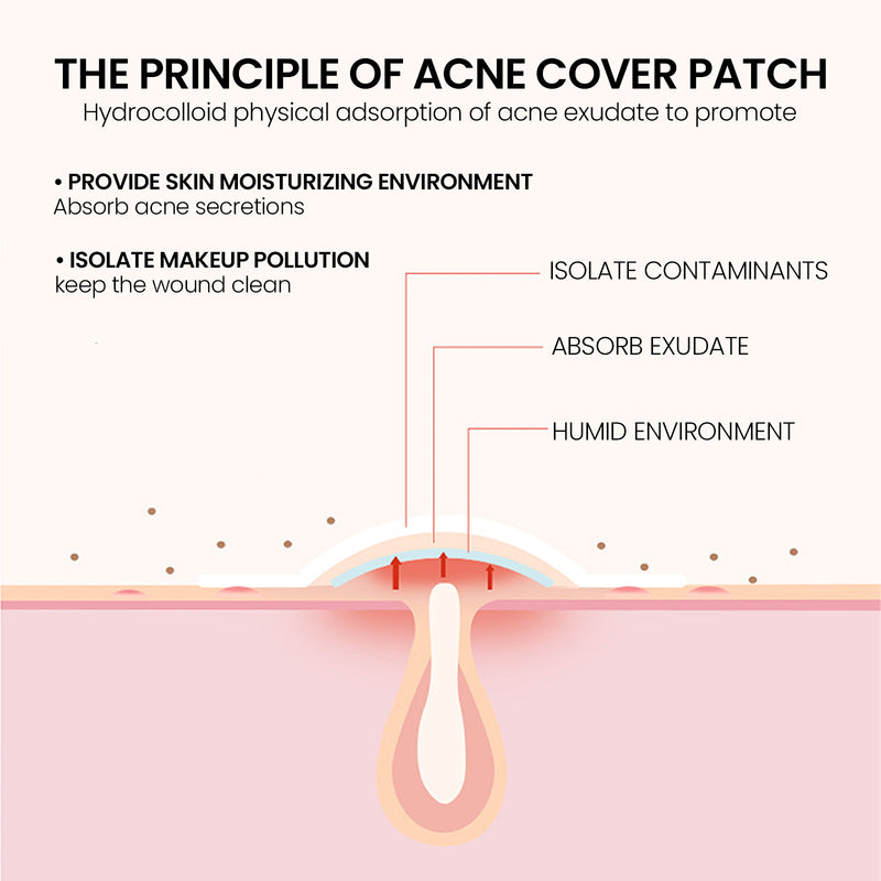 Hydrocolloid Acne Patches - Pimple Removal