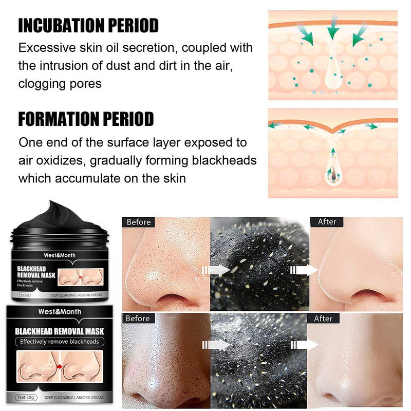 Blackhead Removal Mask - Deep Cleaning